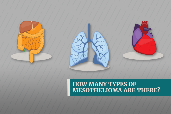 types of mesothelioma
