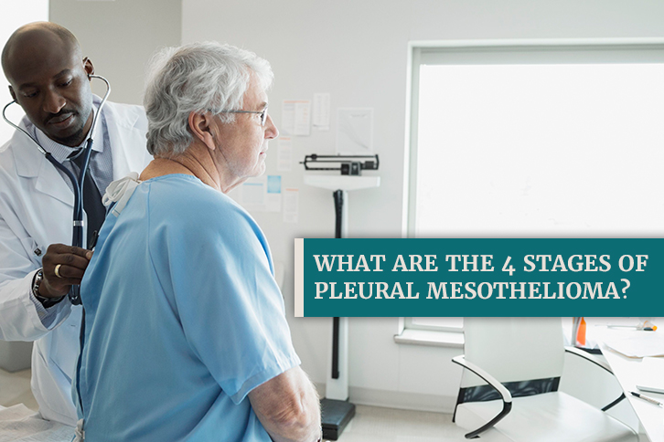 4 stages of pleural mesothelioma